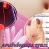 инфекции мочеполовых систем у женщин